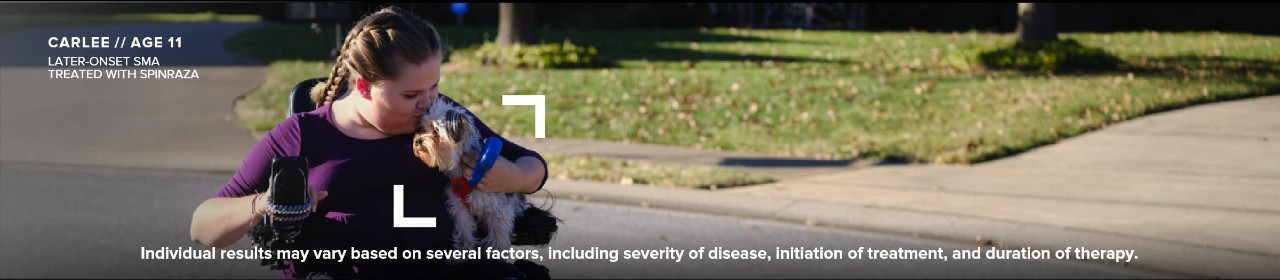 a child with later-onset SMA who is being treated with SPINRAZA
